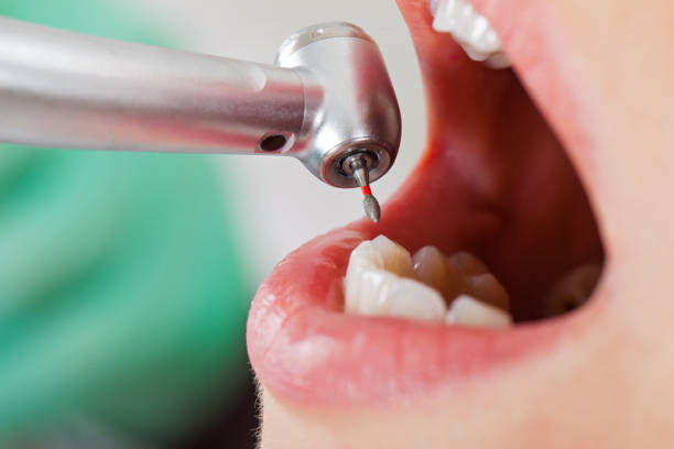 Best Dentist for Tooth Abscess  in Ammon, ID